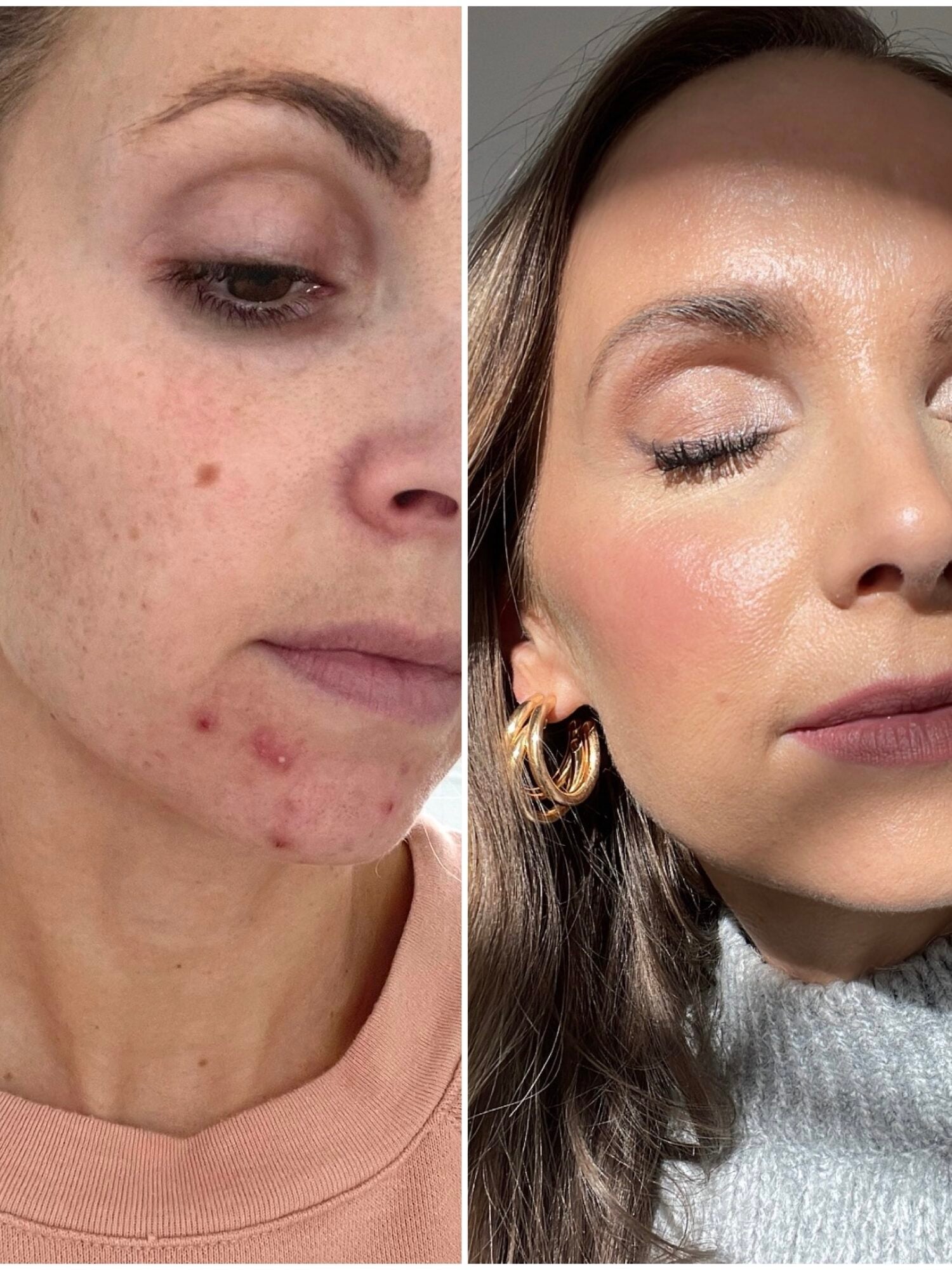 skin care routine 30s and 40s