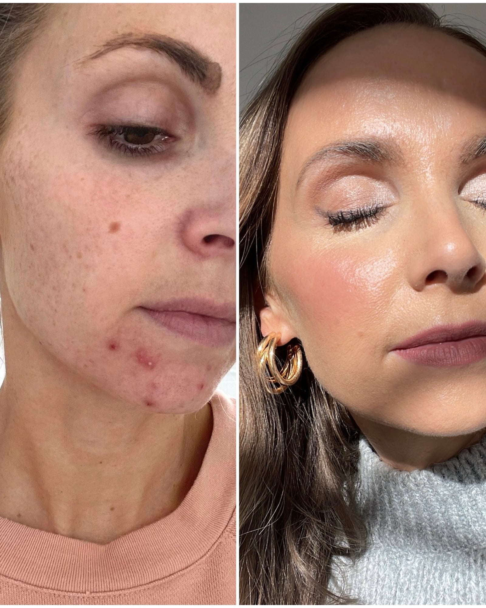 Skin Care Routine for Your 30s and 40s